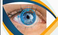 Research Institute for Ophthalmology and Vision Science Brochure